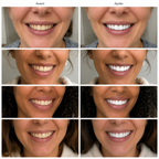 Pétille Strips — Arrête de cacher ton sourire.